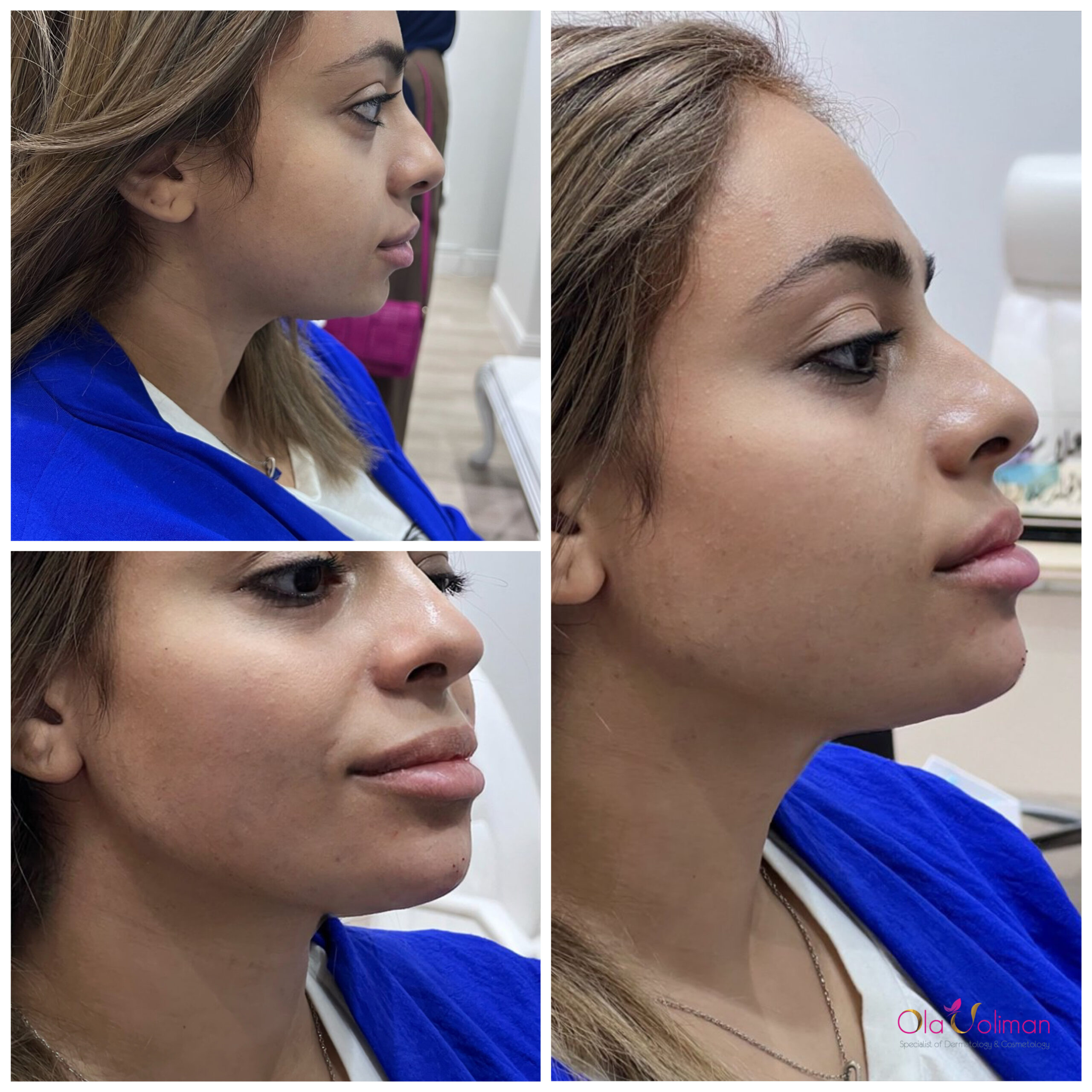 Face makeover
